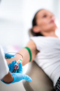 PRP or Platelet Rich Plasma Treatment, Drawing Blood